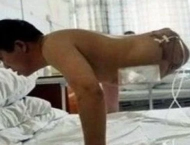 Aυτές είναι οι 5 πιο σοκαριστικές ιατρικές ιστορίες στα χρονικά! (βίντεο)